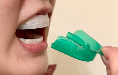 【公式】Opalescence Go｜短時間で歯の黄ばみをケアするホームホワイトニング